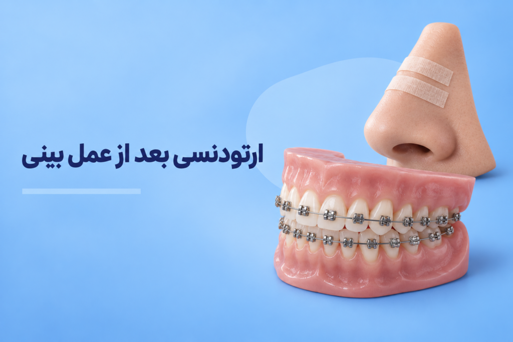 ارتودنسی بعد از عمل بینی