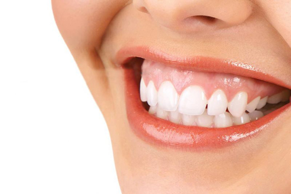 اصلاح لبخند لثه ای