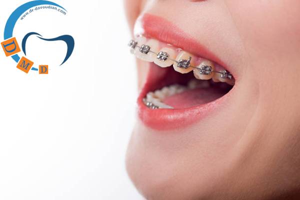 اورژانس ارتودنسی