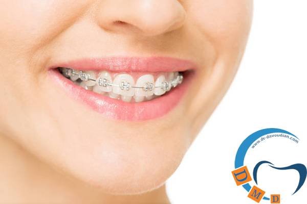 اورژانس ارتودنسی