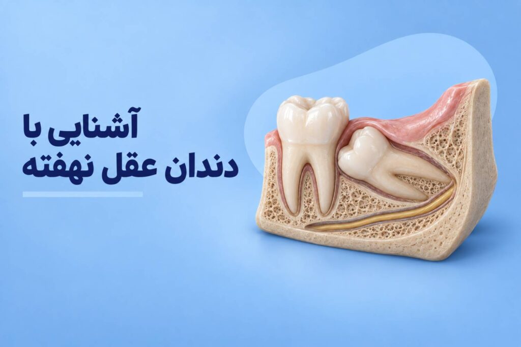 آشنایی با دندان عقل نهفته