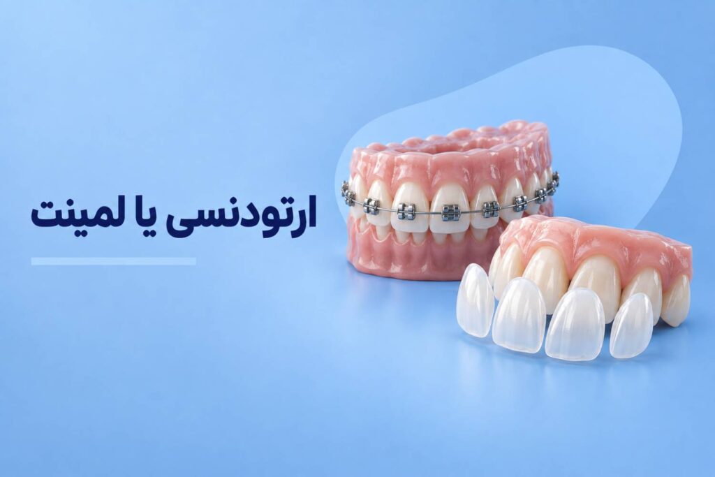 ارتودنسی یا لمینت
