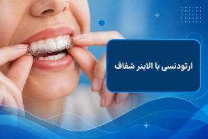 ارتودنسی با الاینر شفاف