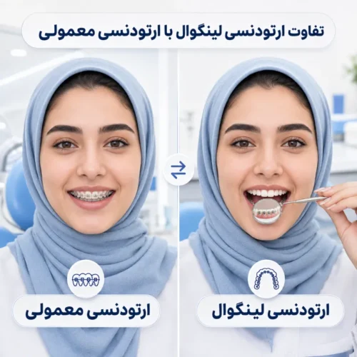 تفاوت ارتودنسی لینگوال با ارتودنسی معمولی