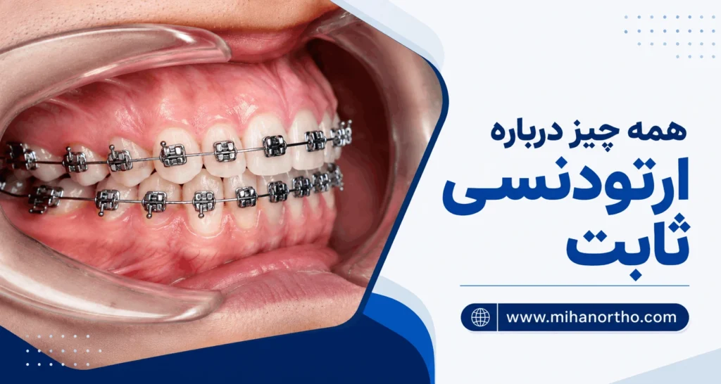 ارتودنسی ثابت