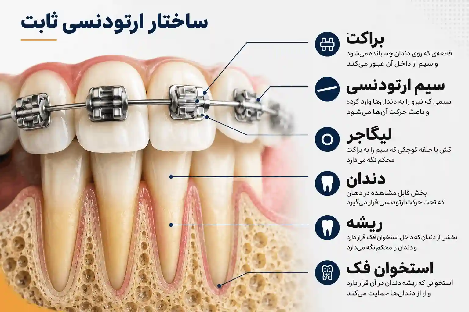 ساختار ارتودنسی ثابت