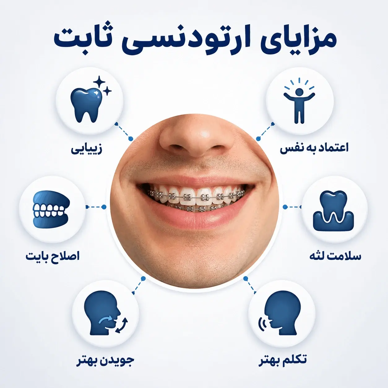 مزایای ارتودنسی ثابت