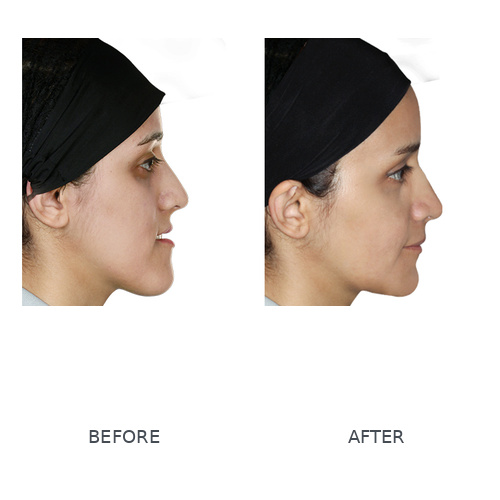 ارتودنسی و جراحی فک