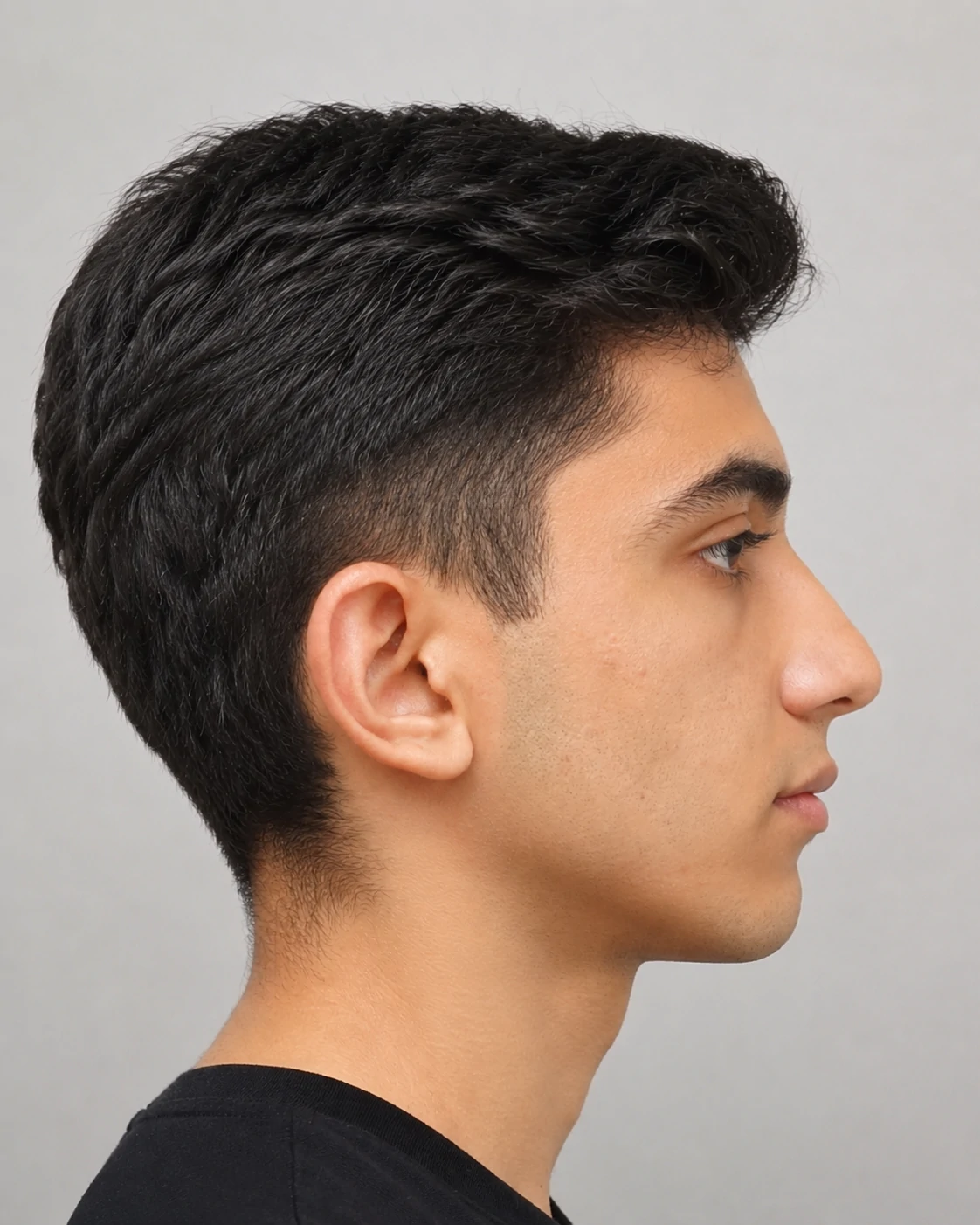 بعد از درمان ارتودنسی دو فک و جراحی فک