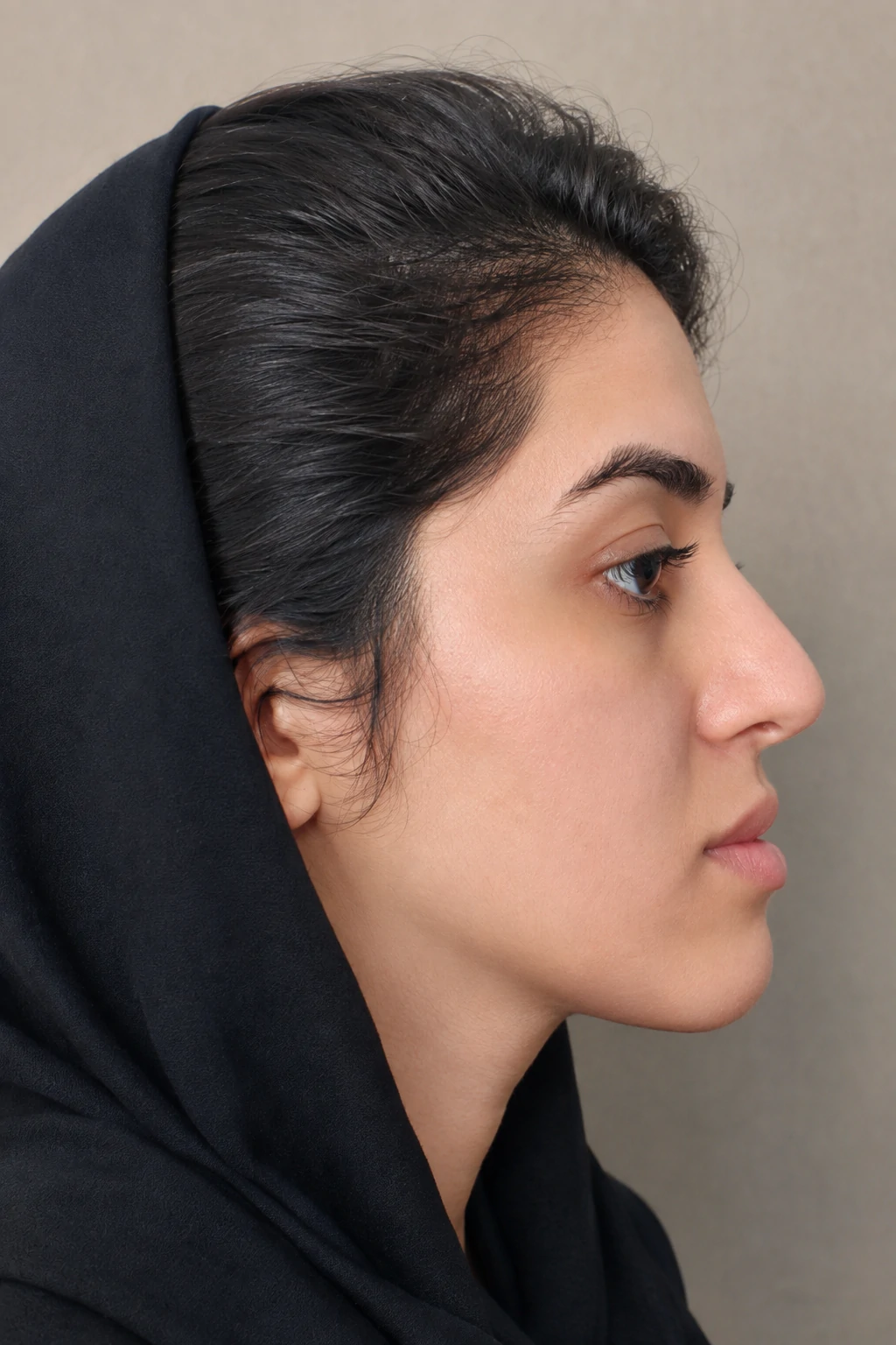بعد از اصلاح ناهنجاری فکی