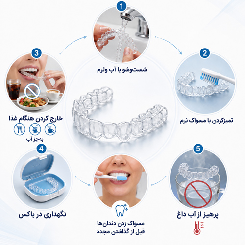 نگهداری از ارتودنسی نامرئی