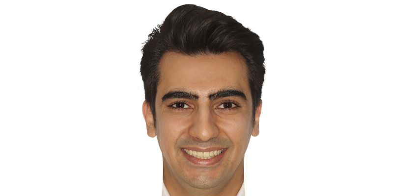 نمای تمام‌رخ صورت بعد از درمان ارتودنسی، کیس اول