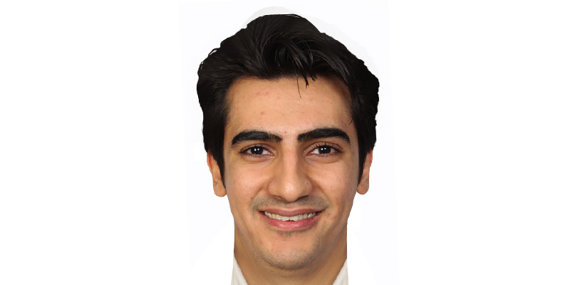 نمای تمام‌رخ صورت قبل از درمان ارتودنسی، کیس اول