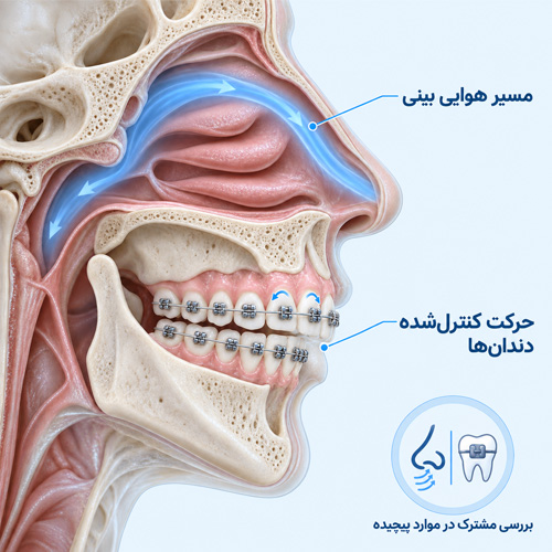 آیا ارتودنسی بعد از عمل بینی روی تنفس تأثیر دارد؟