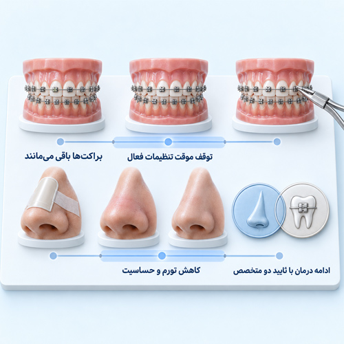 آیا می‌توان ارتودنسی و عمل بینی را همزمان انجام داد؟