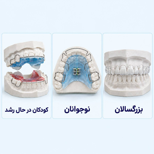 ارتودنسی متحرک برای چه افرادی مناسب است ؟