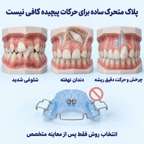 ارتودنسی متحرک برای چه افرادی مناسب نیست ؟