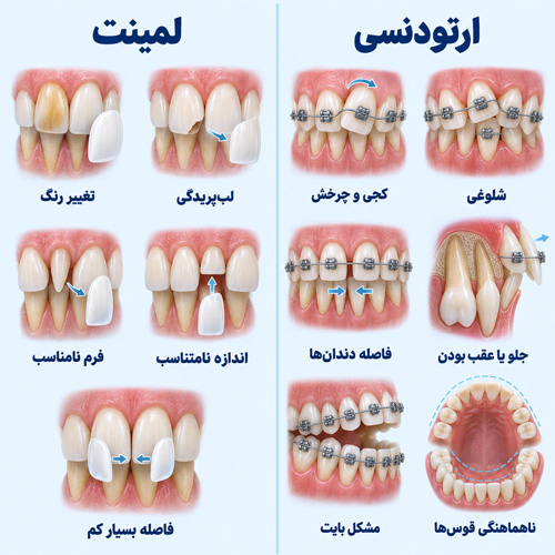 ارتودنسی چه مشکلی را درمان می‌کند و لمینت چه مشکلی را؟