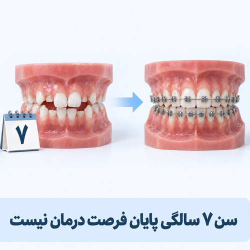 اگر کودک بیشتر از ۷ سال دارد، برای ارتودنسی دیر شده است؟