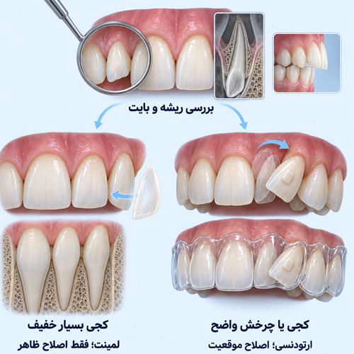 برای دندان کج ارتودنسی بهتر است یا لمینت؟