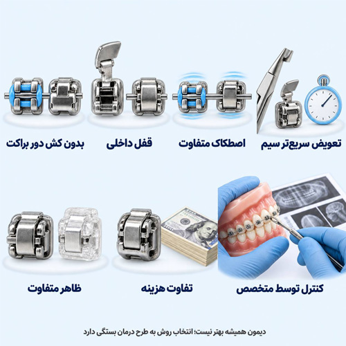 تفاوت ارتودنسی دیمون و براکت سنتی