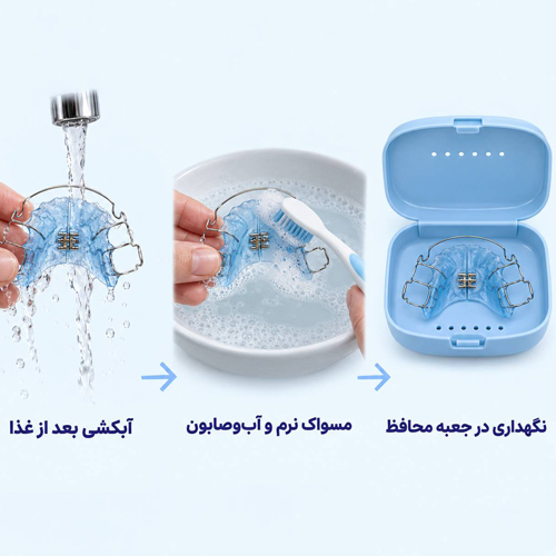 روش های تمیز کردن ارتودنسی متحرک