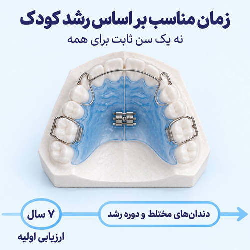 سن مناسب برای ارتودنسی متحرک
