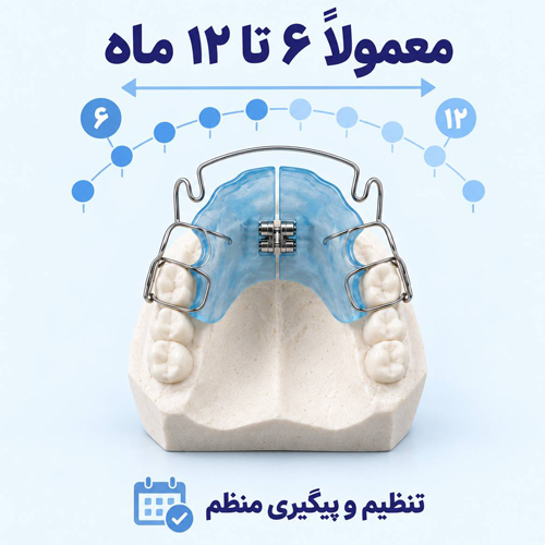 طول درمان ارتودنسی متحرک