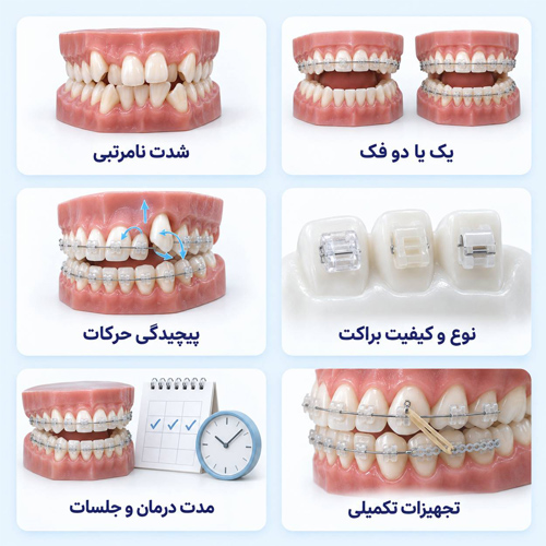 هزینه ارتودنسی سرامیکی