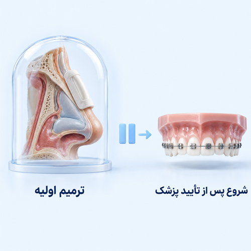 چرا برای شروع ارتودنسی بعد از عمل بینی باید صبر کرد؟