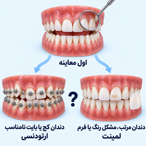 چگونه بفهمیم ارتودنسی یا لمینت برای ما مناسب‌تر است؟