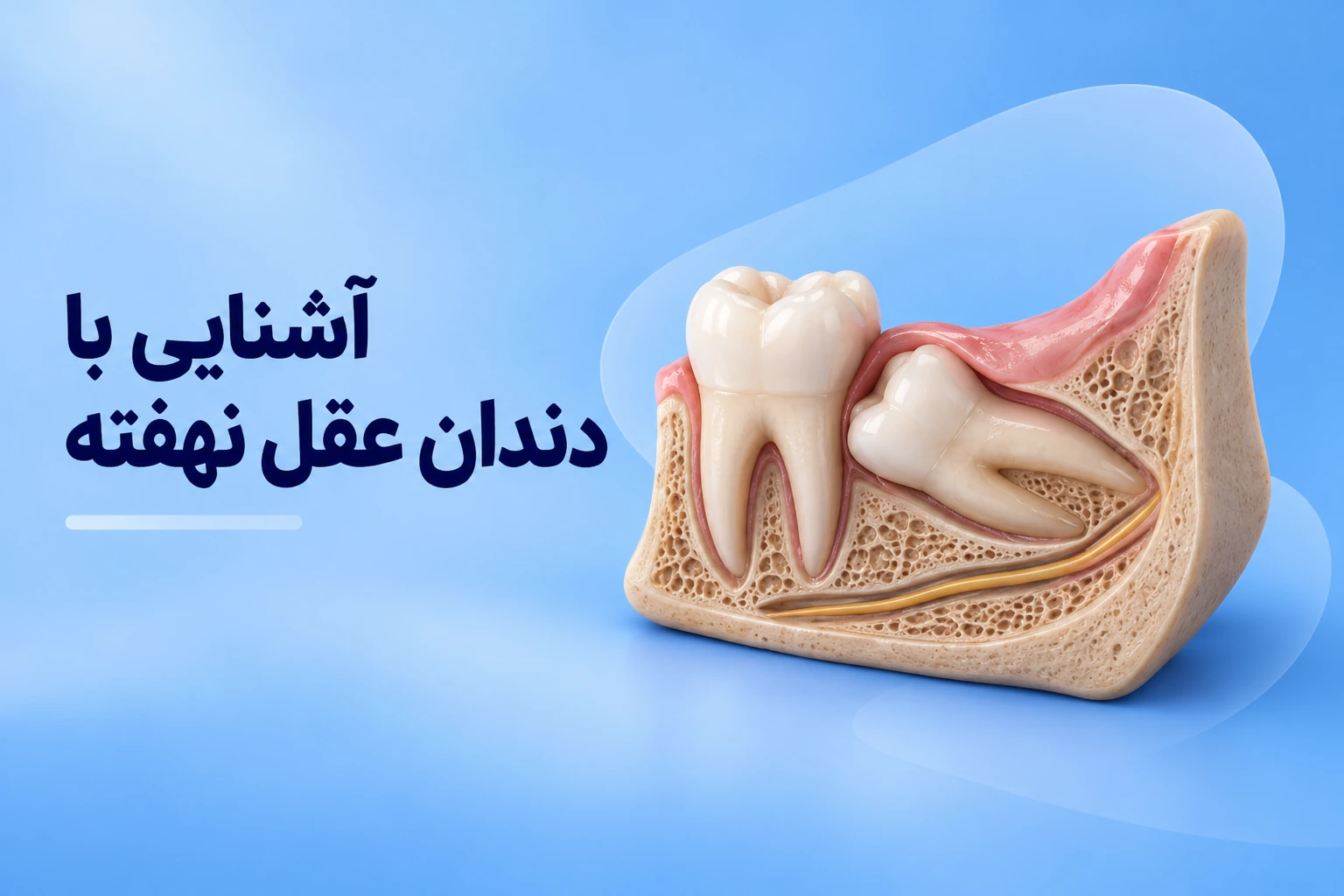 آشنایی با دندان عقل نهفته