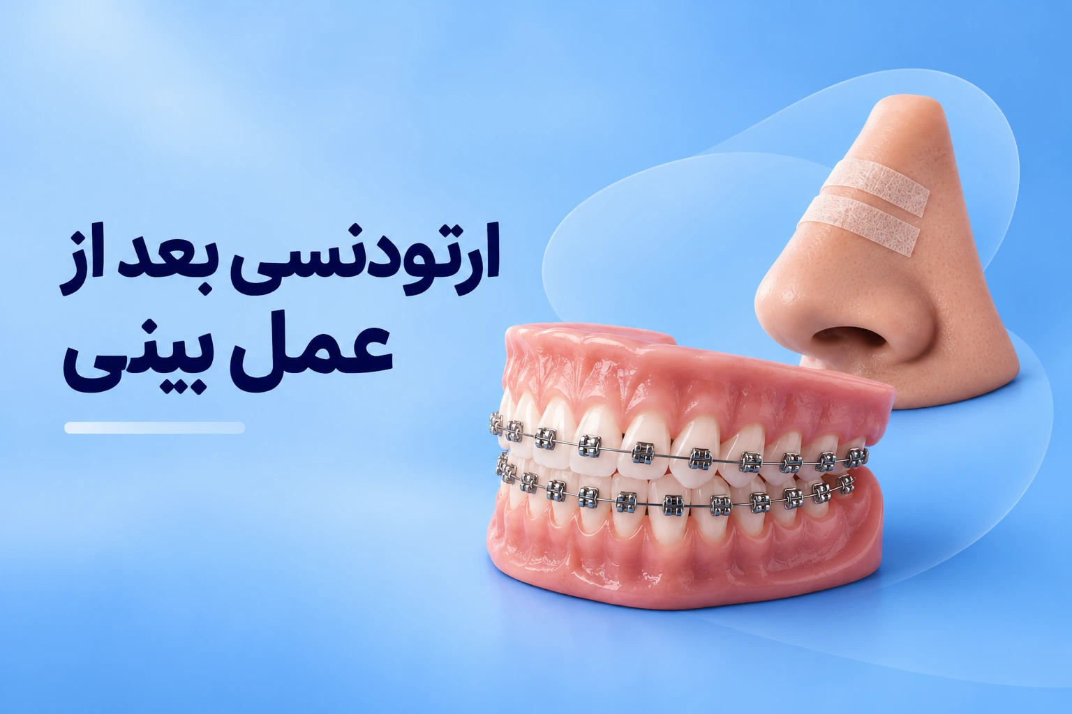 ارتودنسی بعد از عمل بینی