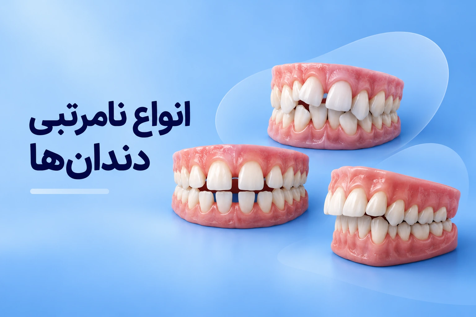 انواع نامرتبی دندانها