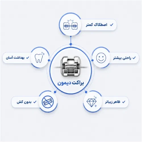 مزایای ارتودنسی دیمون